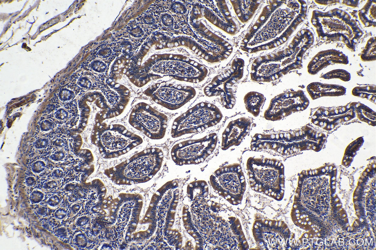 Immunohistochemical analysis of paraffin-embedded human small intestine tissue slide using KHC1070 (CX3CL1 IHC Kit).
