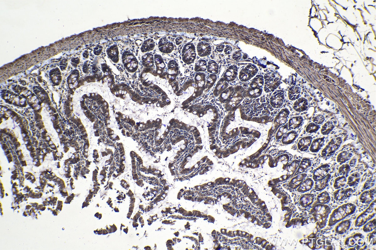 Immunohistochemical analysis of paraffin-embedded rat small intestine tissue slide using KHC1070 (CX3CL1 IHC Kit).