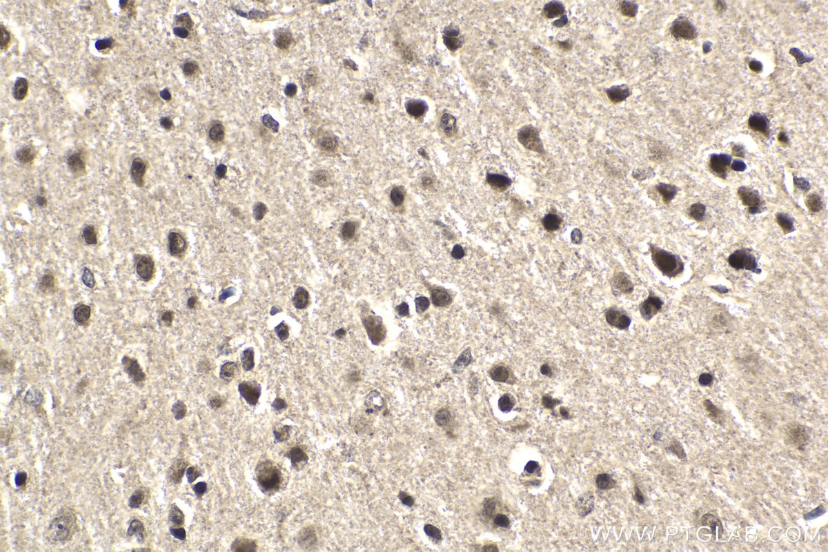 Immunohistochemical analysis of paraffin-embedded mouse brain tissue slide using KHC1799 (CXXC5 IHC Kit).
