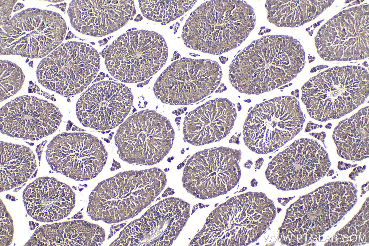 Immunohistochemical analysis of paraffin-embedded mouse testis tissue slide using KHC1799 (CXXC5 IHC Kit).