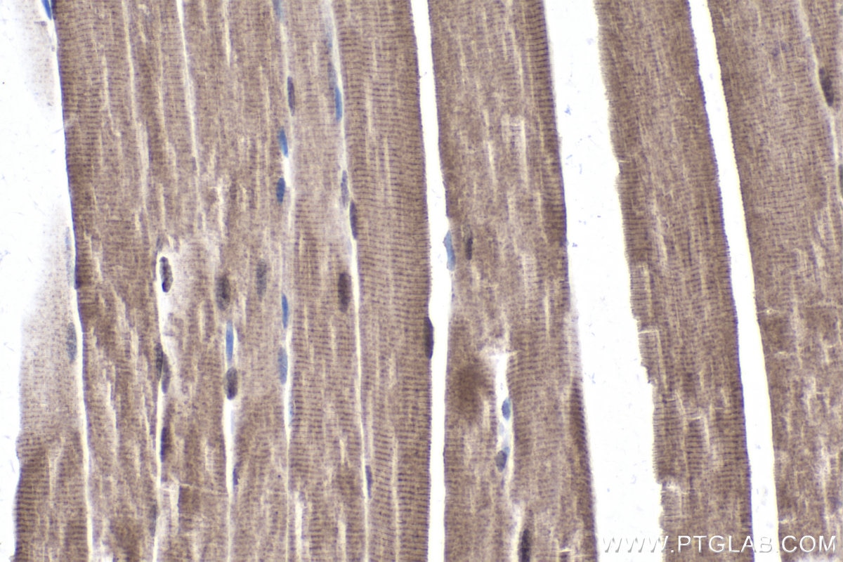 Immunohistochemical analysis of paraffin-embedded mouse skeletal muscle tissue slide using KHC1799 (CXXC5 IHC Kit).