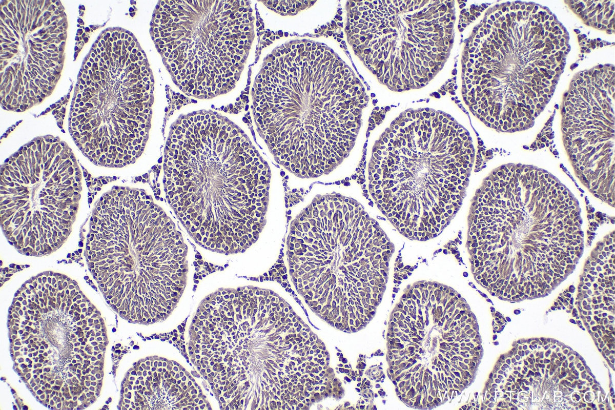 Immunohistochemical analysis of paraffin-embedded rat testis tissue slide using KHC1799 (CXXC5 IHC Kit).