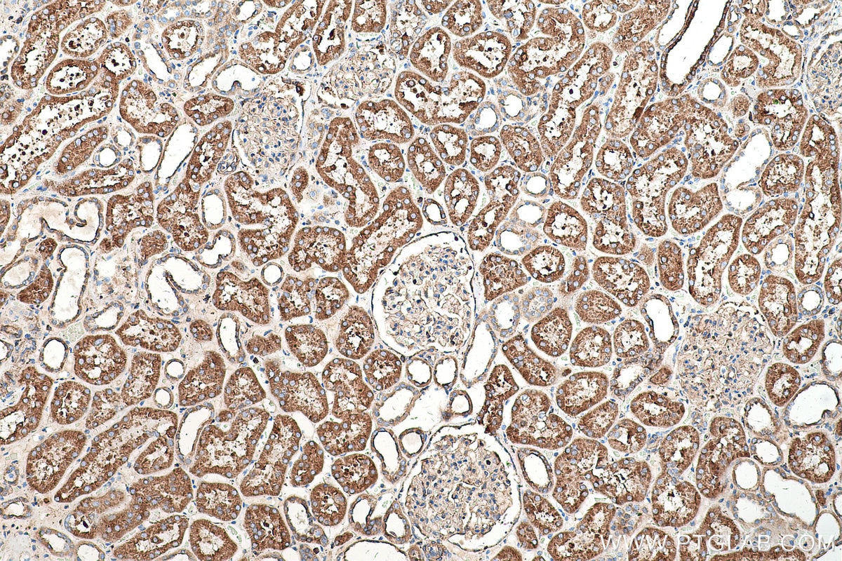 Immunohistochemical analysis of paraffin-embedded human kidney tissue slide using KHC0521 (CYB5A IHC Kit).