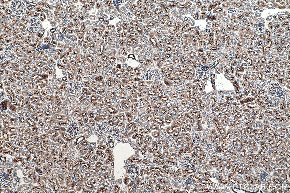 Immunohistochemical analysis of paraffin-embedded mouse kidney tissue slide using KHC0521 (CYB5A IHC Kit).