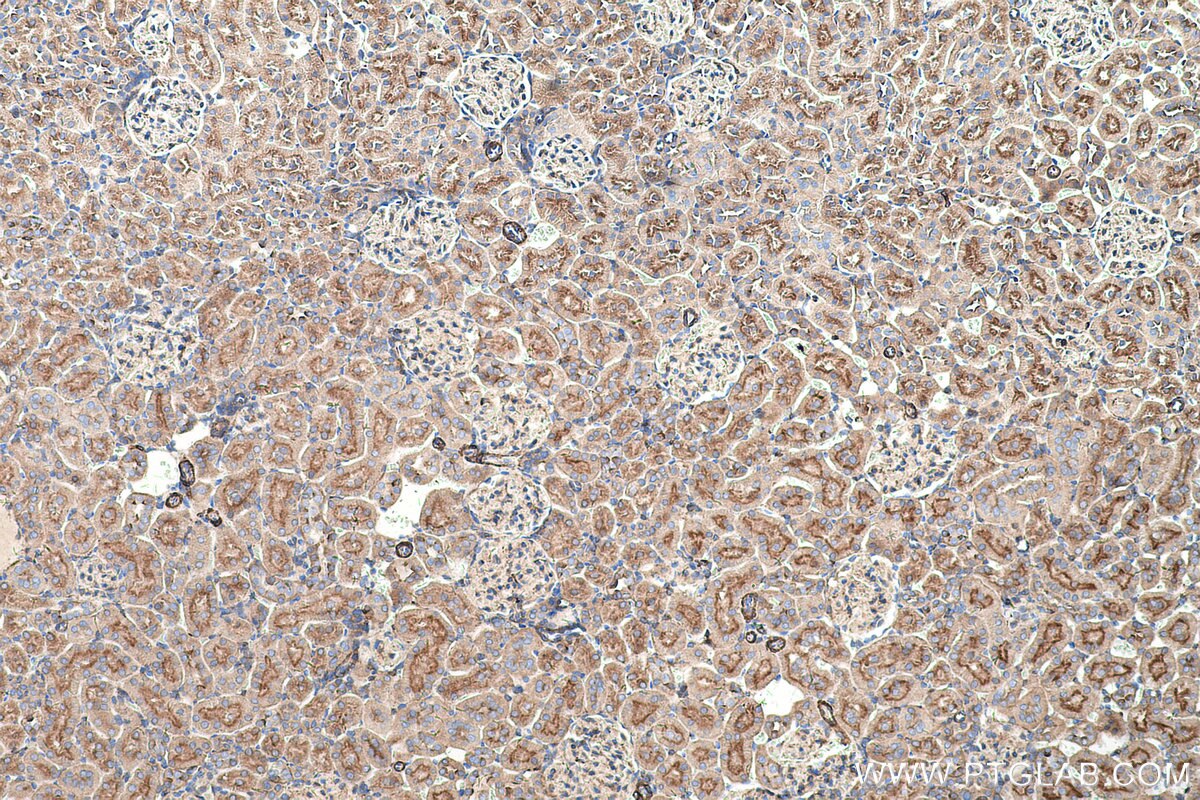 Immunohistochemical analysis of paraffin-embedded rat kidney tissue slide using KHC0521 (CYB5A IHC Kit).