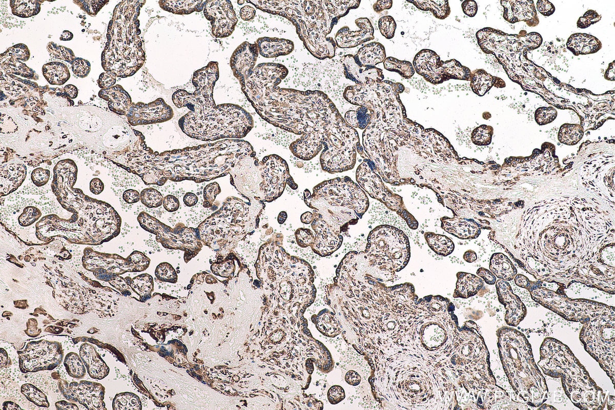 Immunohistochemical analysis of paraffin-embedded human placenta tissue slide using KHC0699 (CYB5R3 IHC Kit).