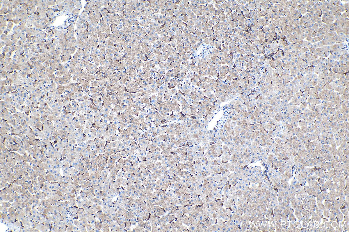 Immunohistochemical analysis of paraffin-embedded human liver tissue slide using KHC1126 (CYBA IHC Kit).