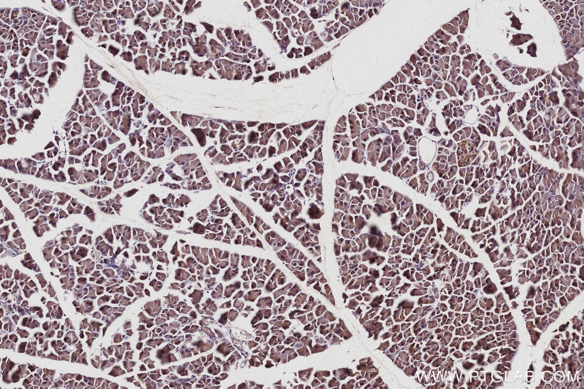 Immunohistochemical analysis of paraffin-embedded mouse pancreas tissue slide using KHC2940 (CYLD IHC Kit).