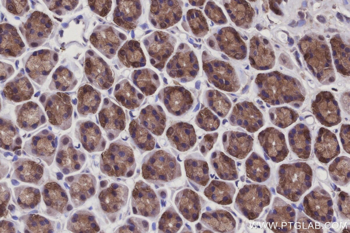 Immunohistochemical analysis of paraffin-embedded rat stomach tissue slide using KHC2940 (CYLD IHC Kit).