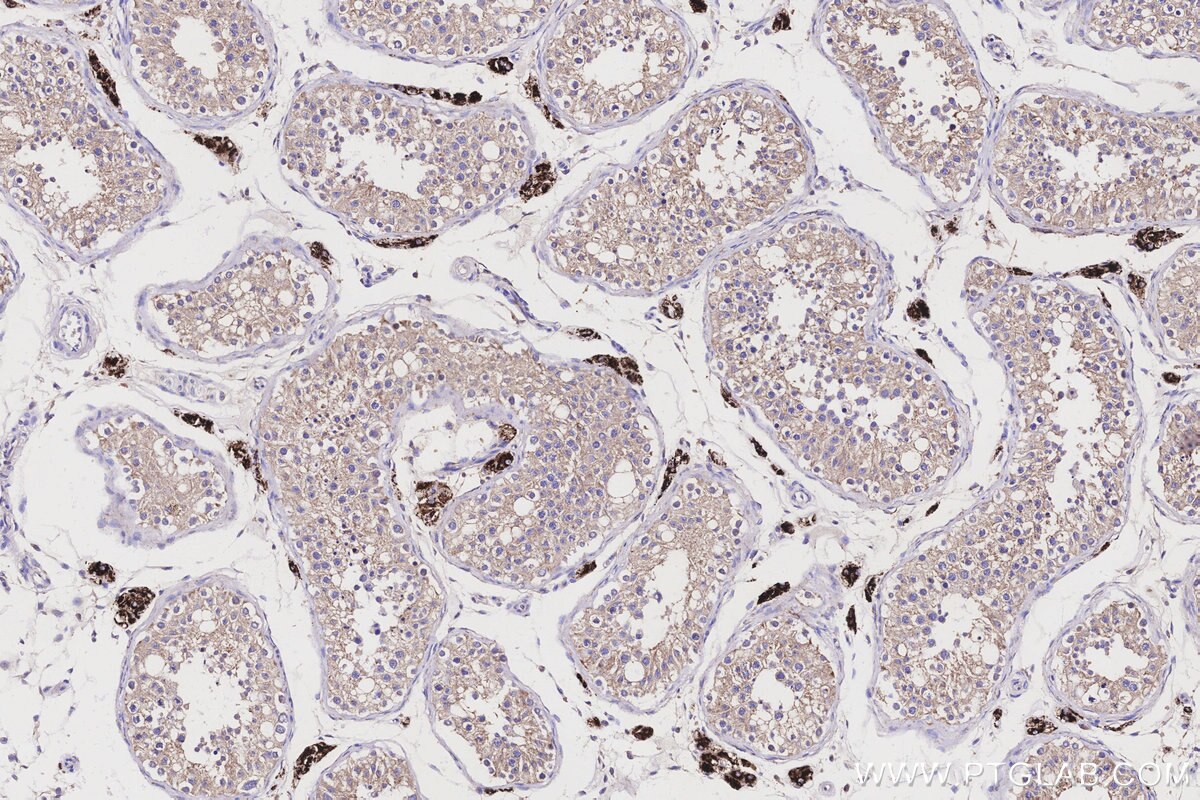 Immunohistochemical analysis of paraffin-embedded human testis tissue slide using KHC3170 (CYP11A1 IHC Kit).