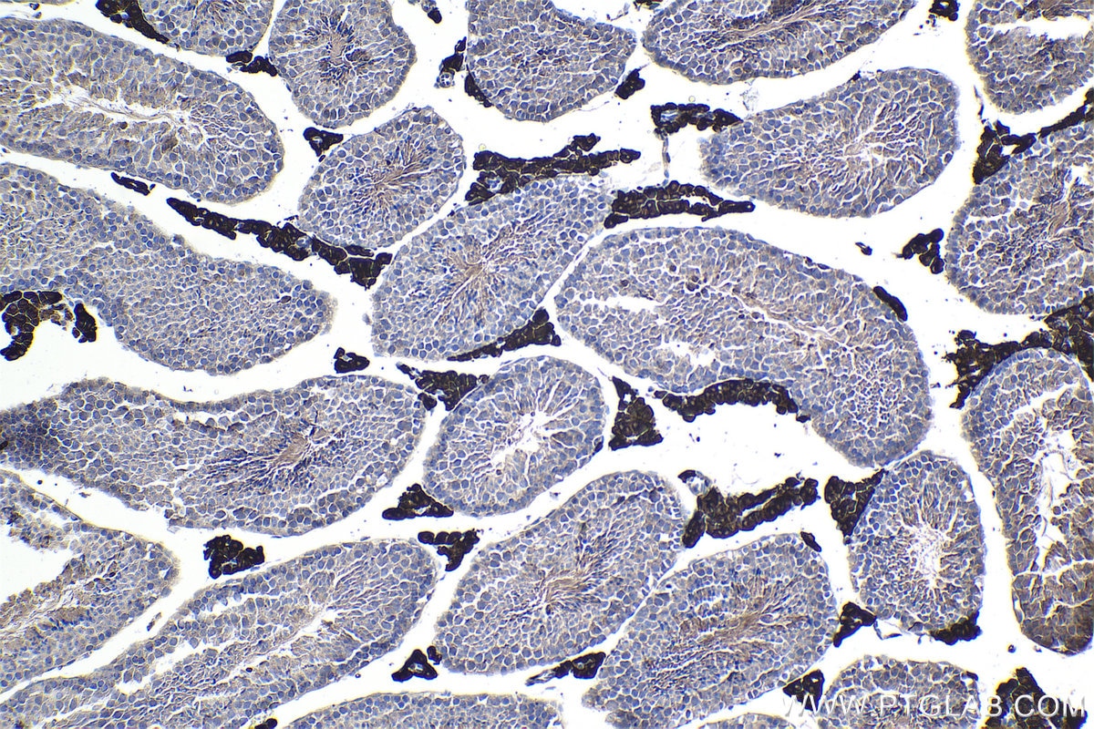 Immunohistochemical analysis of paraffin-embedded mouse testis tissue slide using KHC1085 (CYP17A1 IHC Kit).