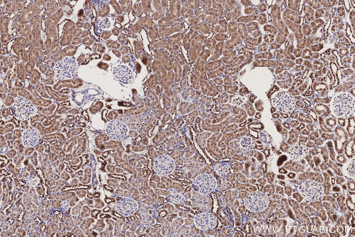 Immunohistochemical analysis of paraffin-embedded rat kidney tissue slide using KHC3172 (CYP1A2 IHC Kit).