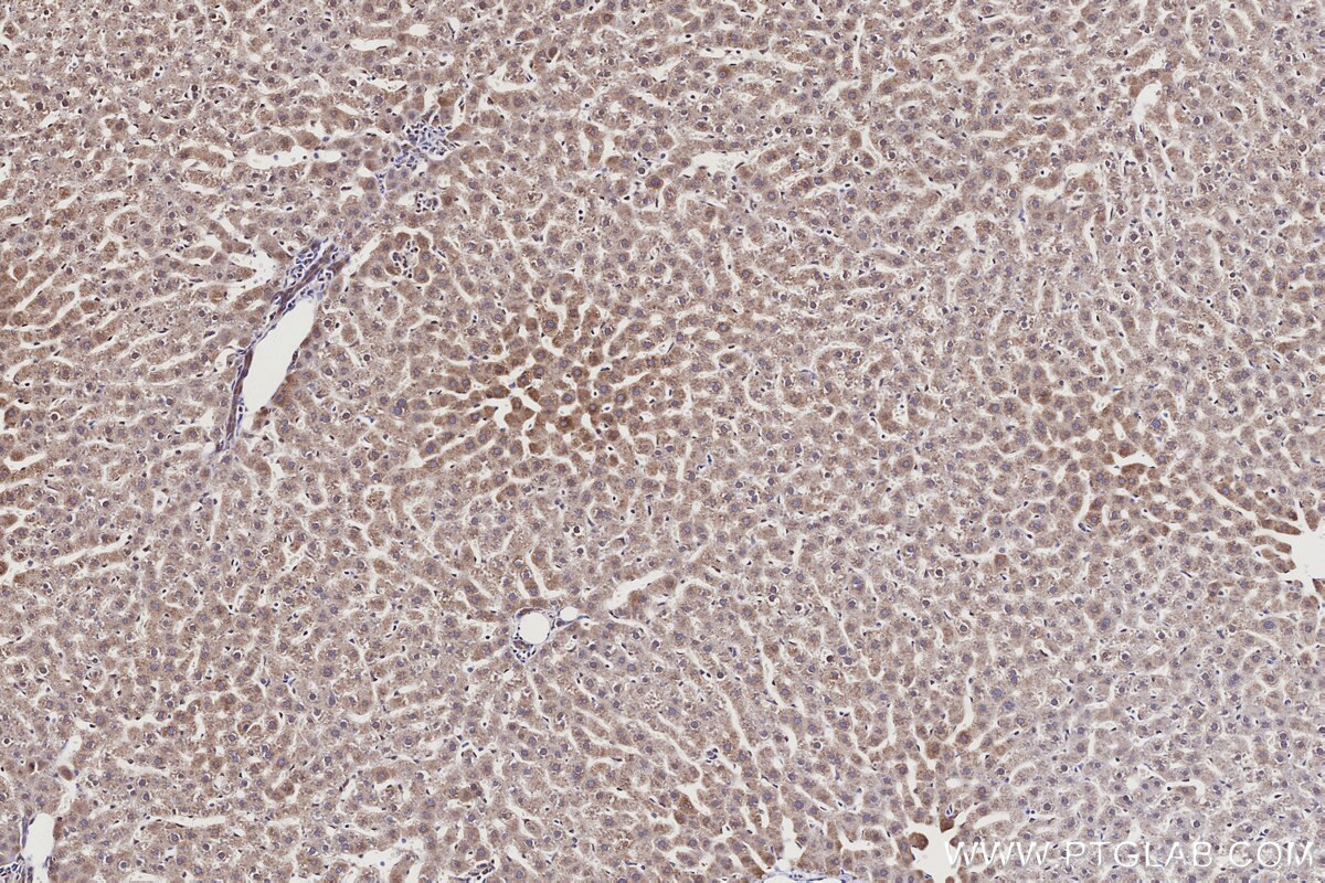 Immunohistochemical analysis of paraffin-embedded rat liver tissue slide using KHC3172 (CYP1A2 IHC Kit).