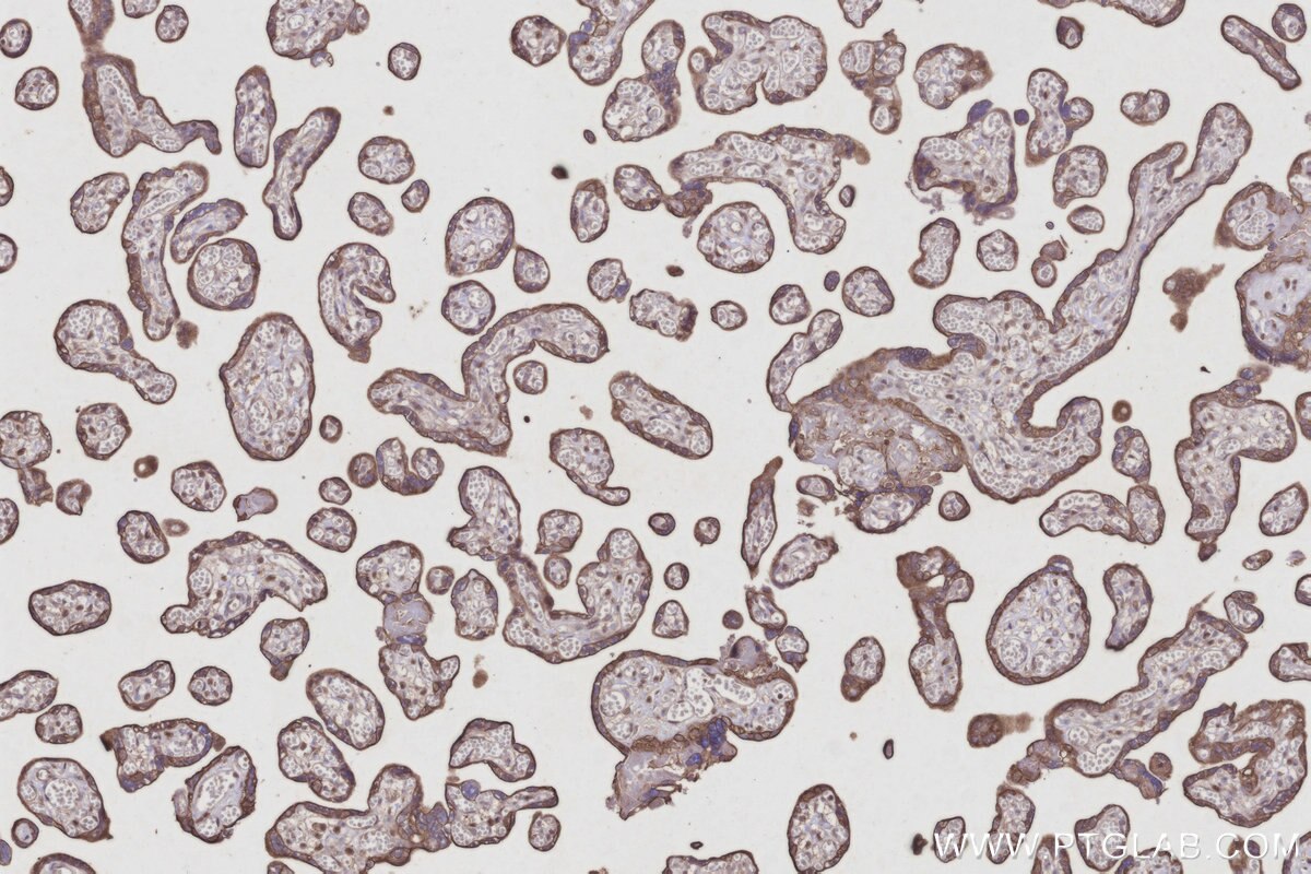 Immunohistochemical analysis of paraffin-embedded human placenta tissue slide using KHC2947 (CYP26B1 IHC Kit). Immunohistochemical analysis of paraffin-embedded human placenta tissue slide using KHC2947 (CYP26B1 IHC Kit).