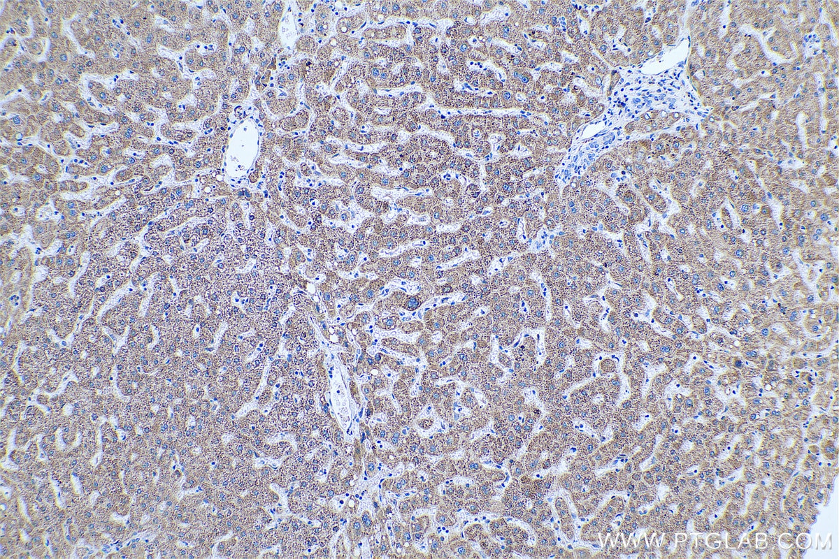 Immunohistochemical analysis of paraffin-embedded human liver tissue slide using KHC0494 (CYP27A1 IHC Kit).