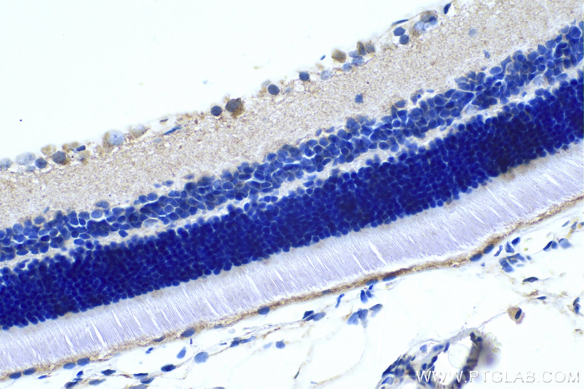 Immunohistochemical analysis of paraffin-embedded rat eye tissue slide using KHC0494 (CYP27A1 IHC Kit).