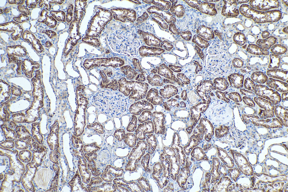 Immunohistochemical analysis of paraffin-embedded human kidney tissue slide using KHC0494 (CYP27A1 IHC Kit).