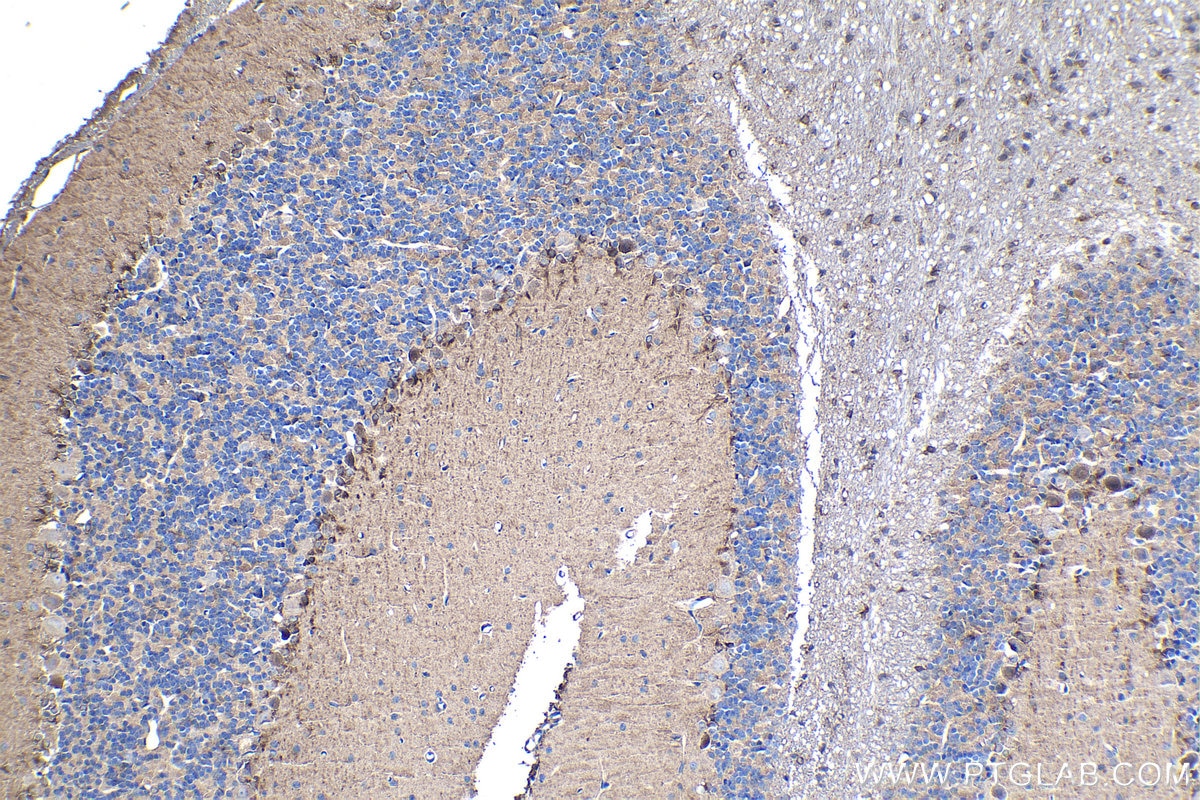 Immunohistochemical analysis of paraffin-embedded rat cerebellum tissue slide using KHC1208 (CYP2D6 IHC Kit).