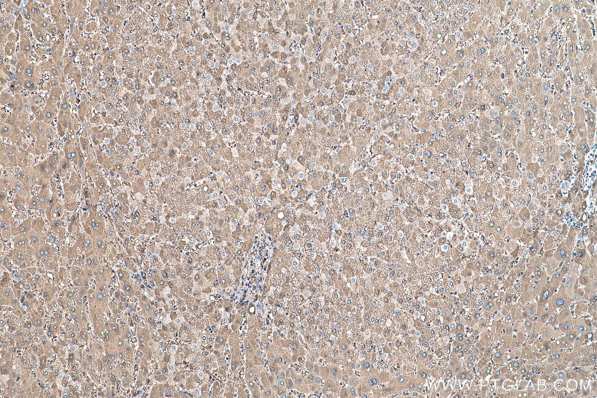 Immunohistochemical analysis of paraffin-embedded human liver tissue slide using KHC0477 (CYP2E1 IHC Kit).