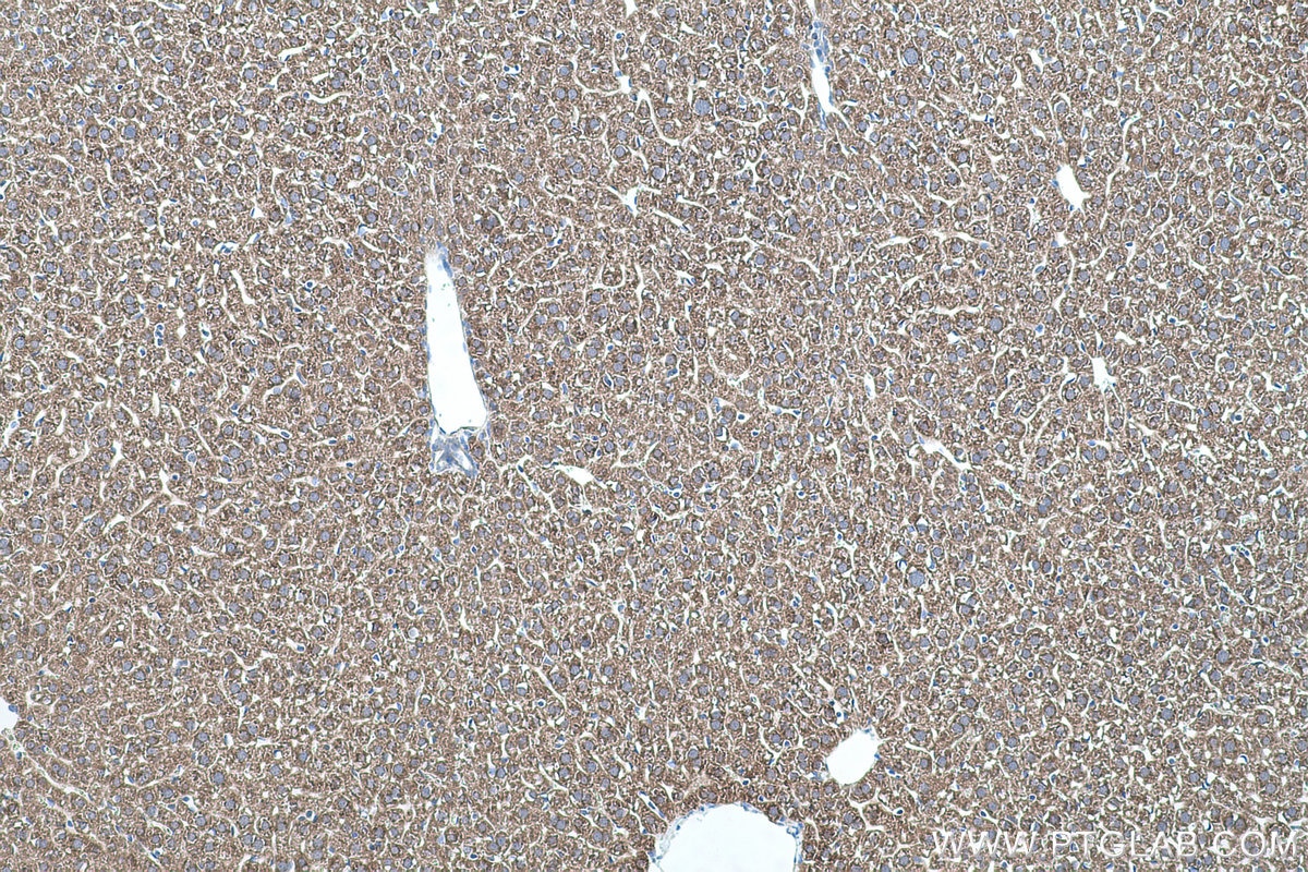 Immunohistochemical analysis of paraffin-embedded mouse liver tissue slide using KHC0413 (CYP2J2 IHC Kit).