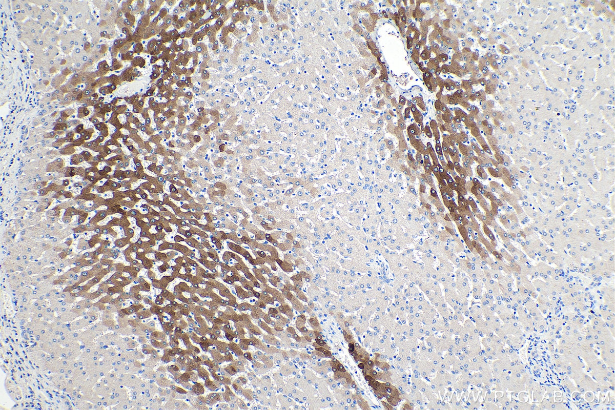 Immunohistochemical analysis of paraffin-embedded human liver tissue slide using KHC0387 (CYP3A4 IHC Kit).