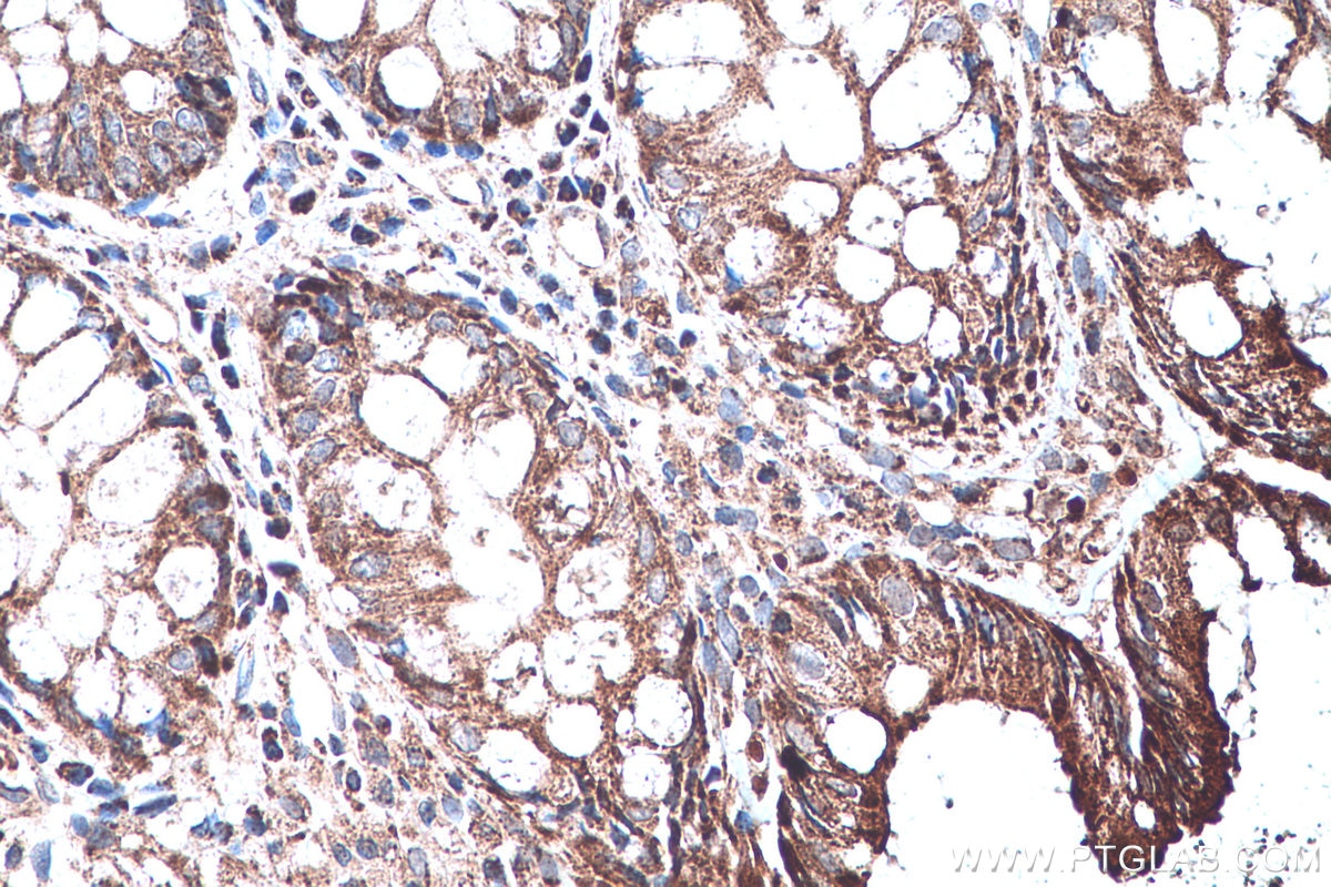 Immunohistochemical analysis of paraffin-embedded human colon tissue slide using KHC0486 (CYP7B1 IHC Kit).