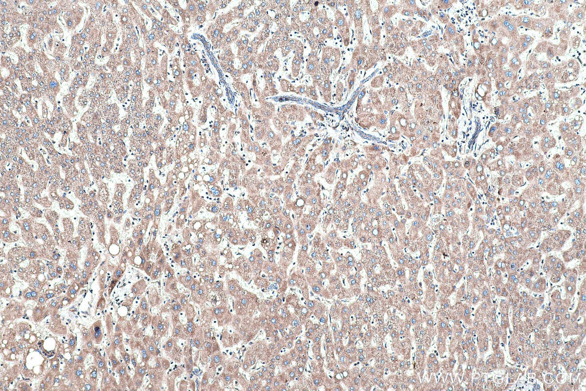 Immunohistochemical analysis of paraffin-embedded human liver tissue slide using KHC0486 (CYP7B1 IHC Kit).