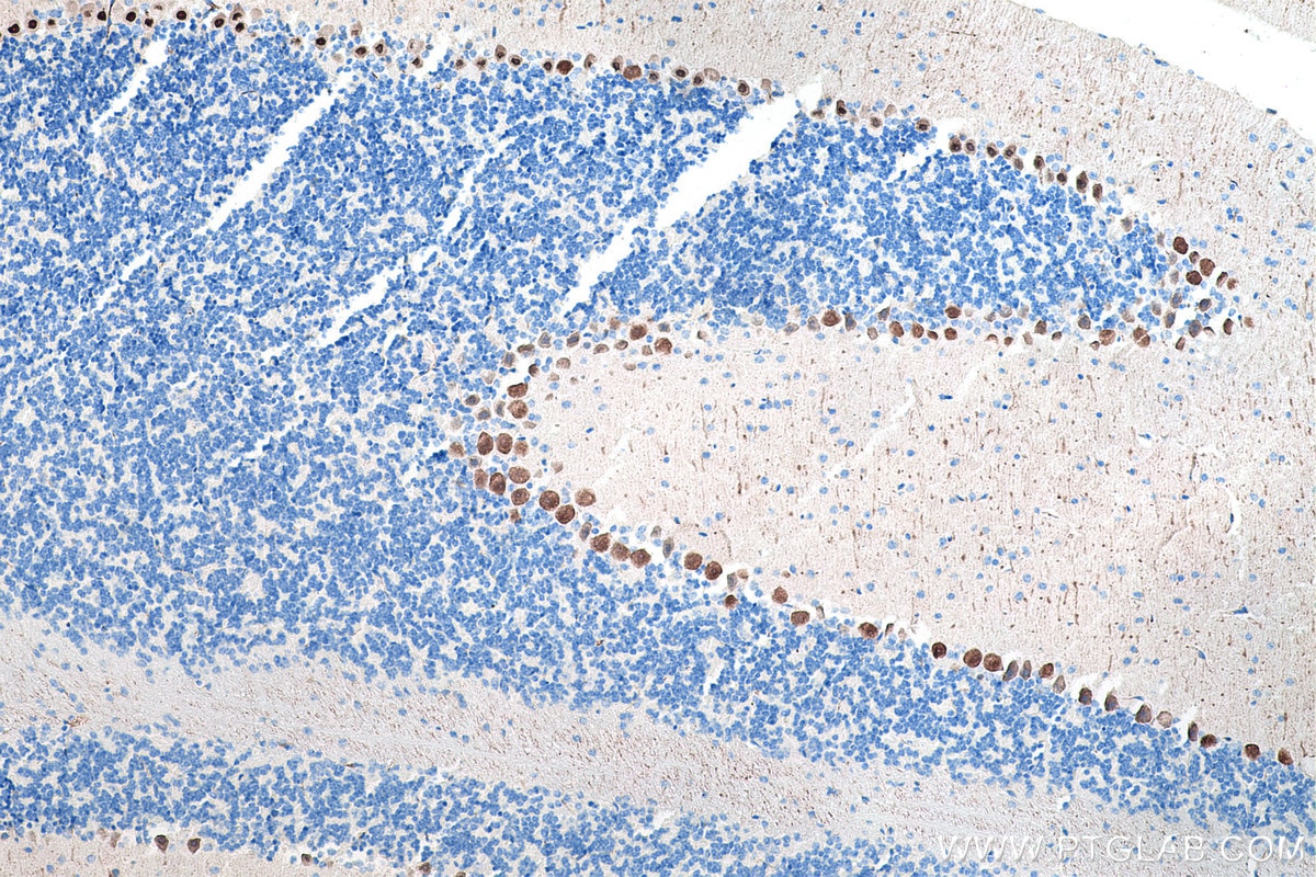 Immunohistochemical analysis of paraffin-embedded mouse cerebellum tissue slide using KHC0188 (Calbindin-D28k IHC Kit).