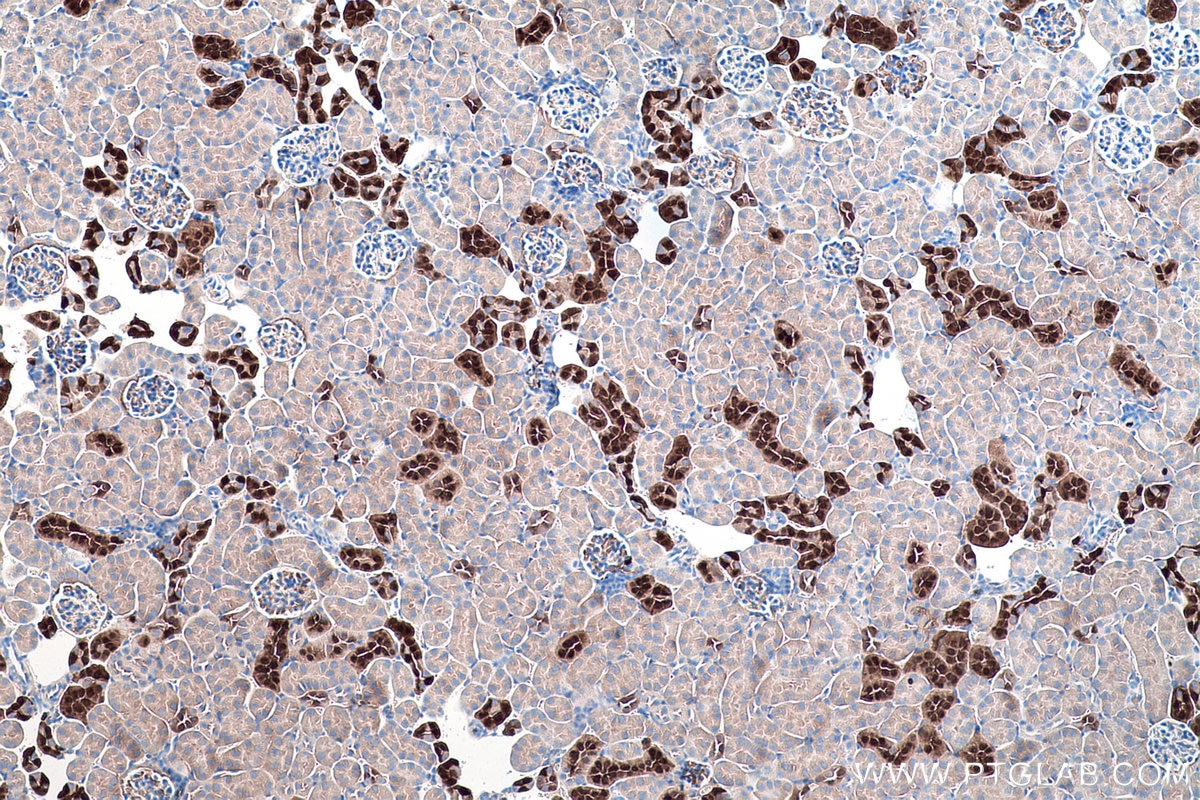 Immunohistochemical analysis of paraffin-embedded mouse kidney tissue slide using KHC0188 (Calbindin-D28k IHC Kit).