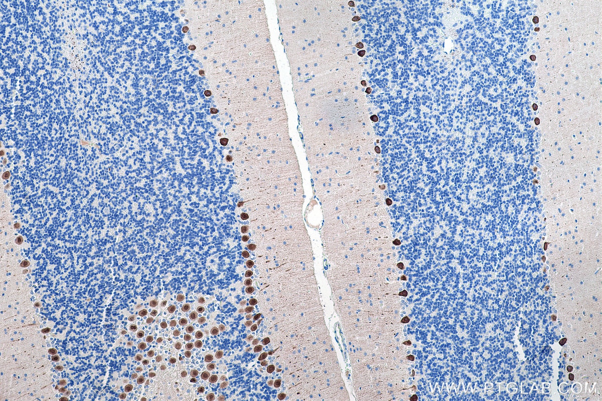 Immunohistochemical analysis of paraffin-embedded rat cerebellum tissue slide using KHC0188 (Calbindin-D28k IHC Kit).