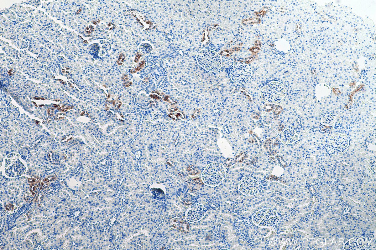 Immunohistochemical analysis of paraffin-embedded rat kidney tissue slide using KHC0188 (Calbindin-D28k IHC Kit).