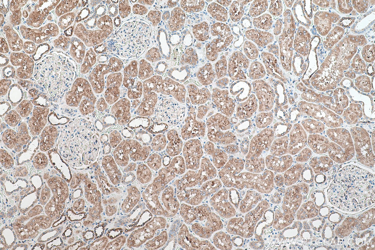 Immunohistochemical analysis of paraffin-embedded human kidney tissue slide using KHC0572 (Calnexin IHC Kit).