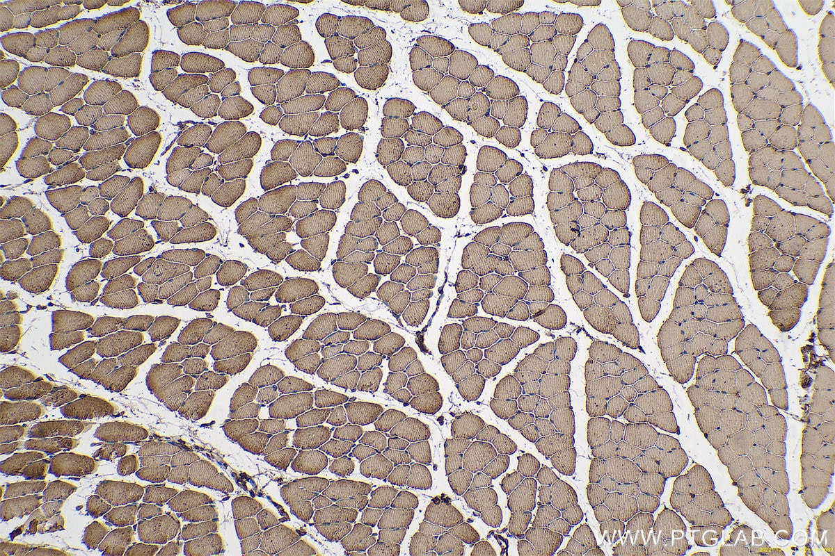 Immunohistochemical analysis of paraffin-embedded mouse skeletal muscle tissue slide using KHC0572 (Calnexin IHC Kit).