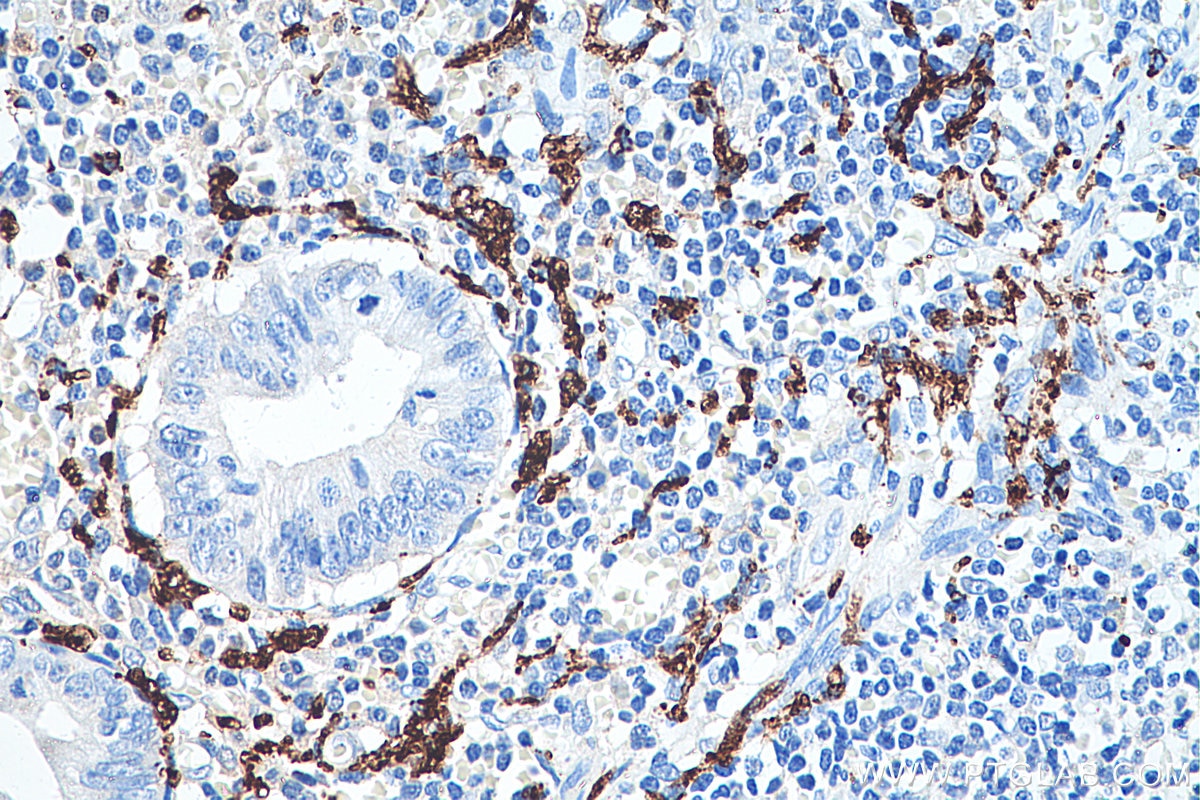 Immunohistochemical analysis of paraffin-embedded human appendicitis tissue slide using KHC0276 (Calretinin IHC Kit).