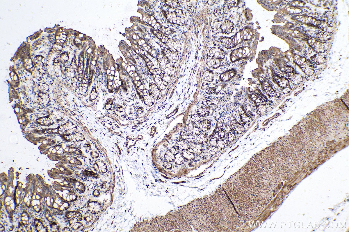 Immunohistochemical analysis of paraffin-embedded rat colon tissue slide using KHC0606 (Caspase 2/p32/p18 IHC Kit).