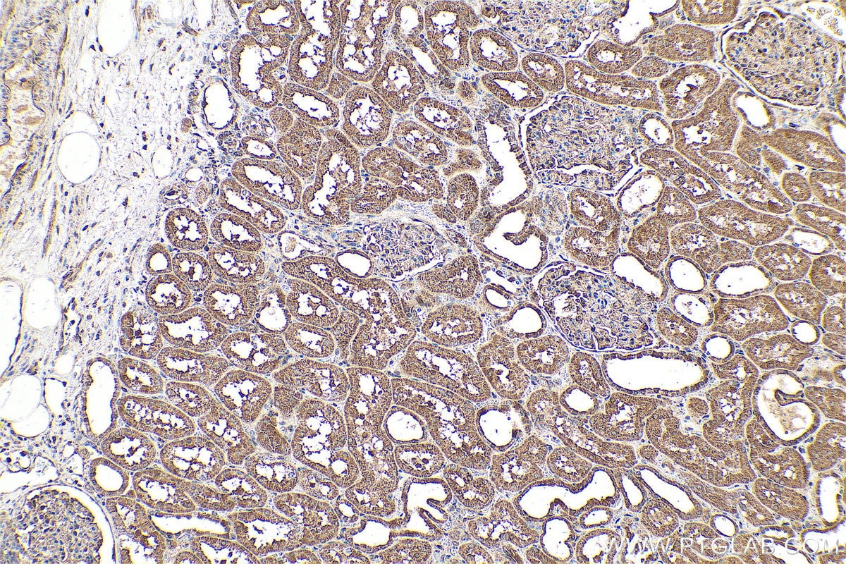 Immunohistochemical analysis of paraffin-embedded human kidney tissue slide using KHC0606 (Caspase 2/p32/p18 IHC Kit).