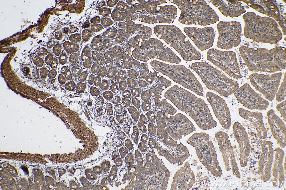 Immunohistochemical analysis of paraffin-embedded mouse small intestine tissue slide using KHC0606 (Caspase 2/p32/p18 IHC Kit).