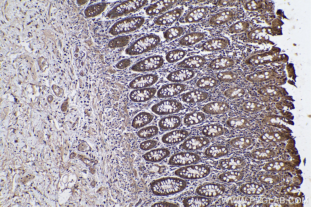 Immunohistochemical analysis of paraffin-embedded human colon tissue slide using KHC0606 (Caspase 2/p32/p18 IHC Kit).