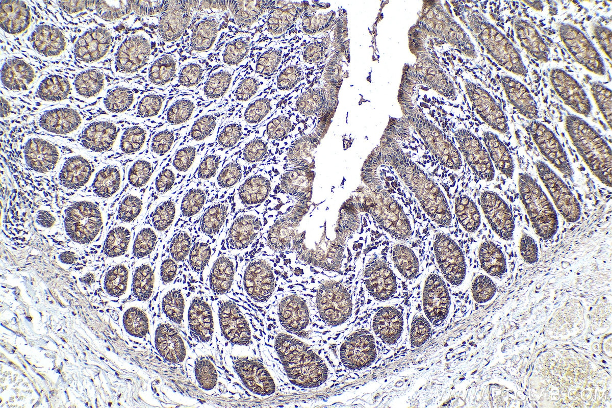 Immunohistochemical analysis of paraffin-embedded human colon tissue slide using KHC0373 (Cathepsin B IHC Kit).