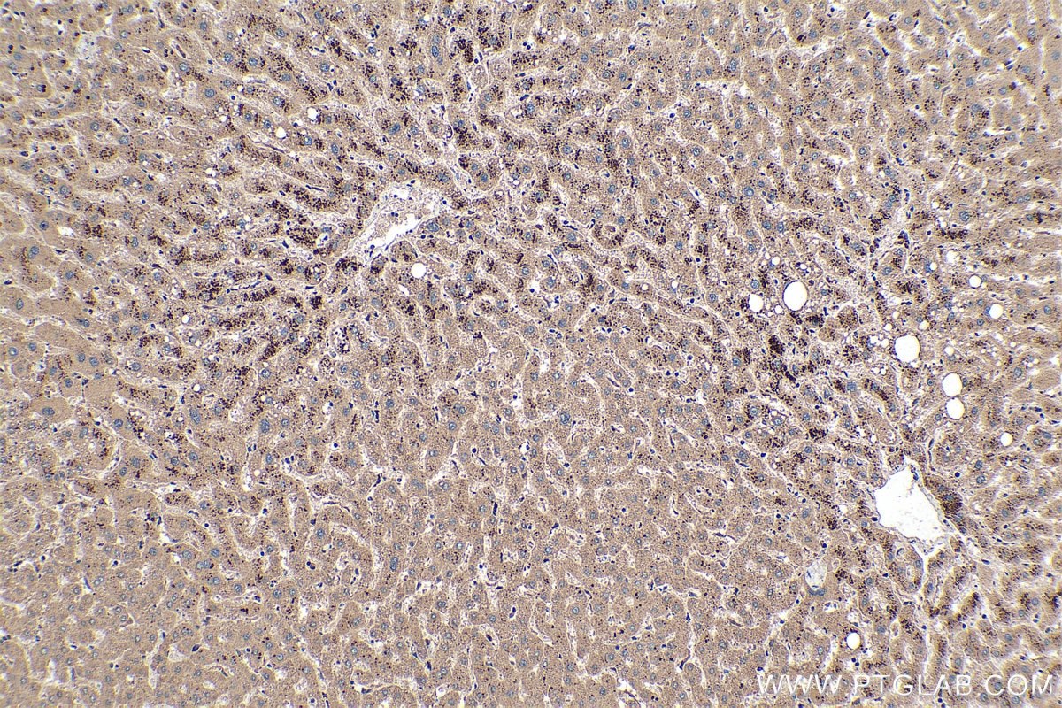 Immunohistochemical analysis of paraffin-embedded human liver tissue slide using KHC0373 (Cathepsin B IHC Kit).