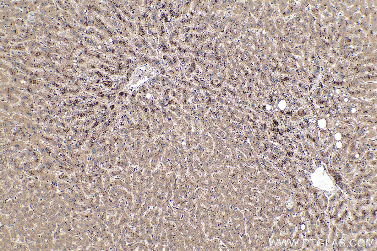 Immunohistochemical analysis of paraffin-embedded human liver tissue slide using KHC0373 (Cathepsin B IHC Kit).