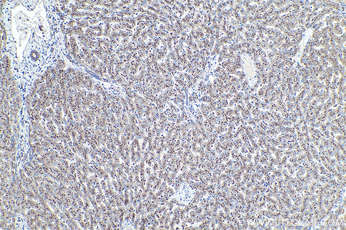 Immunohistochemical analysis of paraffin-embedded human liver tissue slide using KHC0374 (Cathepsin D IHC Kit).