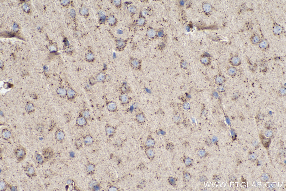 Immunohistochemical analysis of paraffin-embedded mouse brain tissue slide using KHC0374 (Cathepsin D IHC Kit).