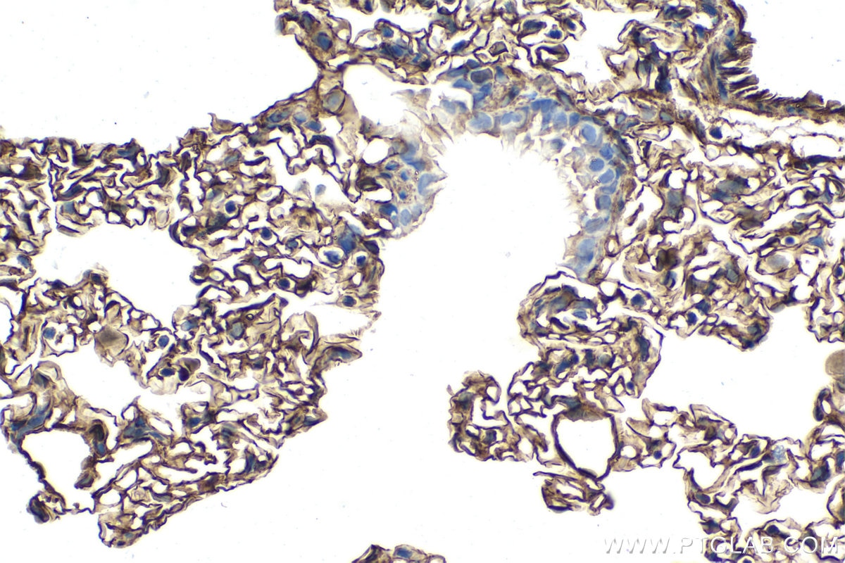 Immunohistochemical analysis of paraffin-embedded rat lung tissue slide using KHC1326 (Caveolin-1 IHC Kit).