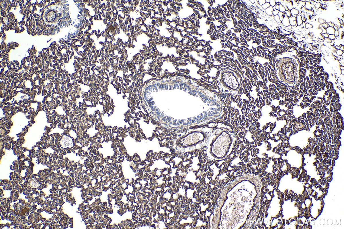 Immunohistochemical analysis of paraffin-embedded mouse lung tissue slide using KHC1326 (Caveolin-1 IHC Kit).
