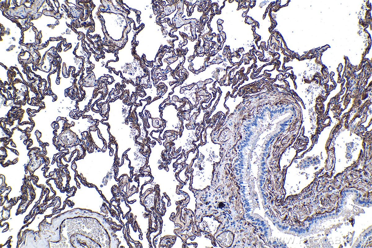 Immunohistochemical analysis of paraffin-embedded human lung tissue slide using KHC1326 (Caveolin-1 IHC Kit).