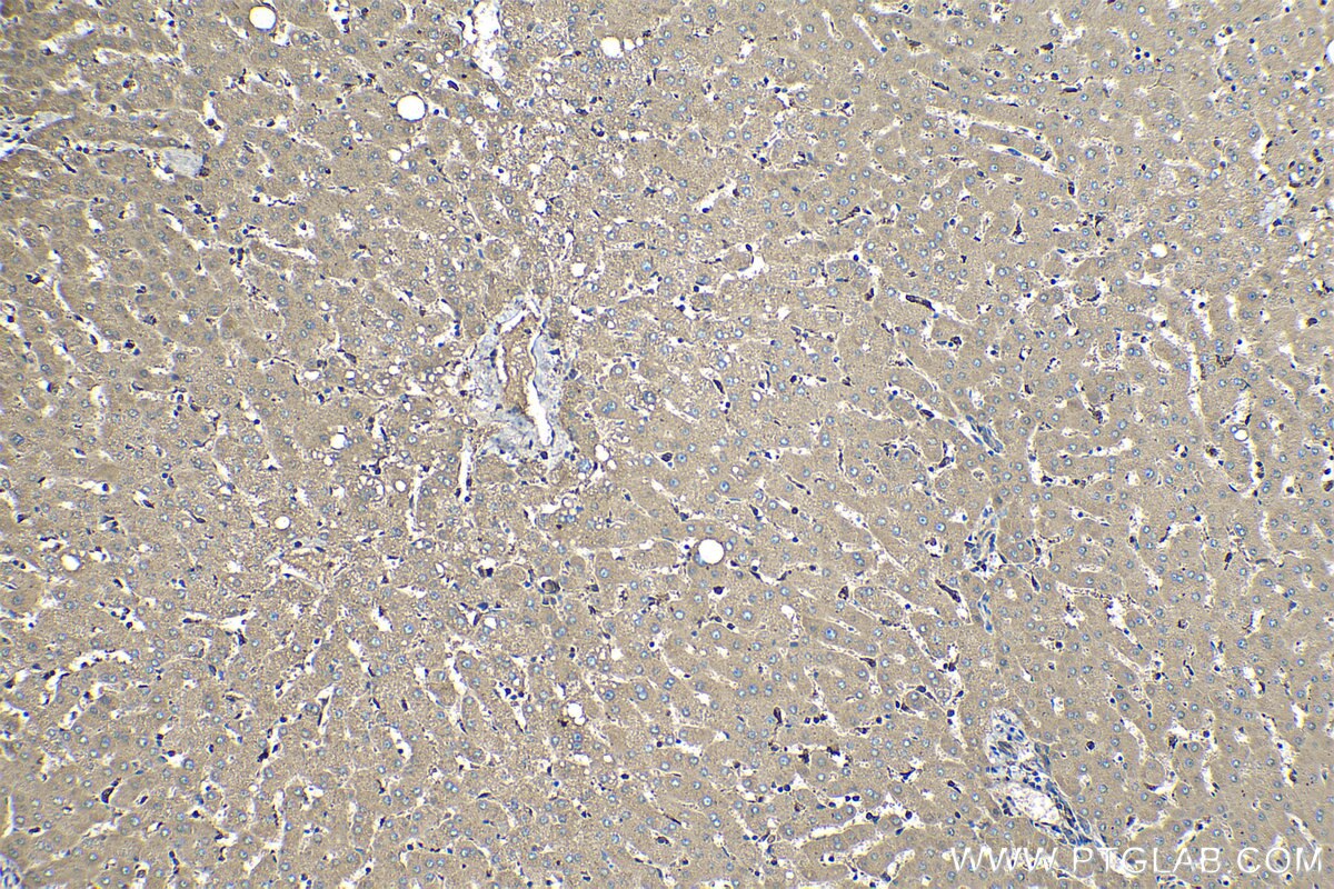 Immunohistochemical analysis of paraffin-embedded human liver tissue slide using KHC1122 (Ceruloplasmin/CP IHC Kit).