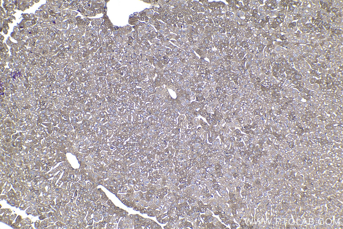 Immunohistochemical analysis of paraffin-embedded mouse liver tissue slide using KHC1122 (Ceruloplasmin/CP IHC Kit).