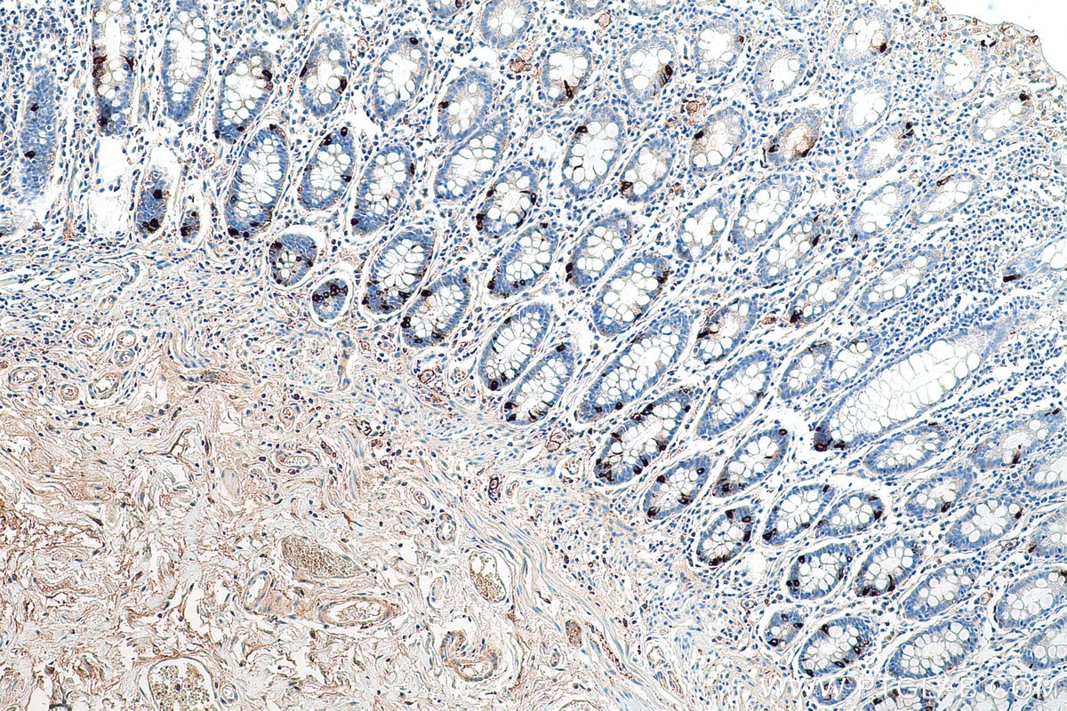 Immunohistochemical analysis of paraffin-embedded human colon tissue slide using KHC0602 (CgA/CHGA IHC Kit).