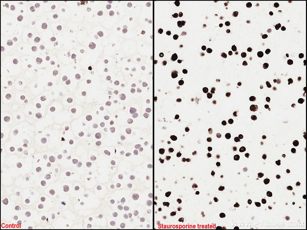 Immunohistochemical analysis of paraffin-embedded Jurkat cells slide using KHC2512 (Cleaved PARP1 IHC Kit).